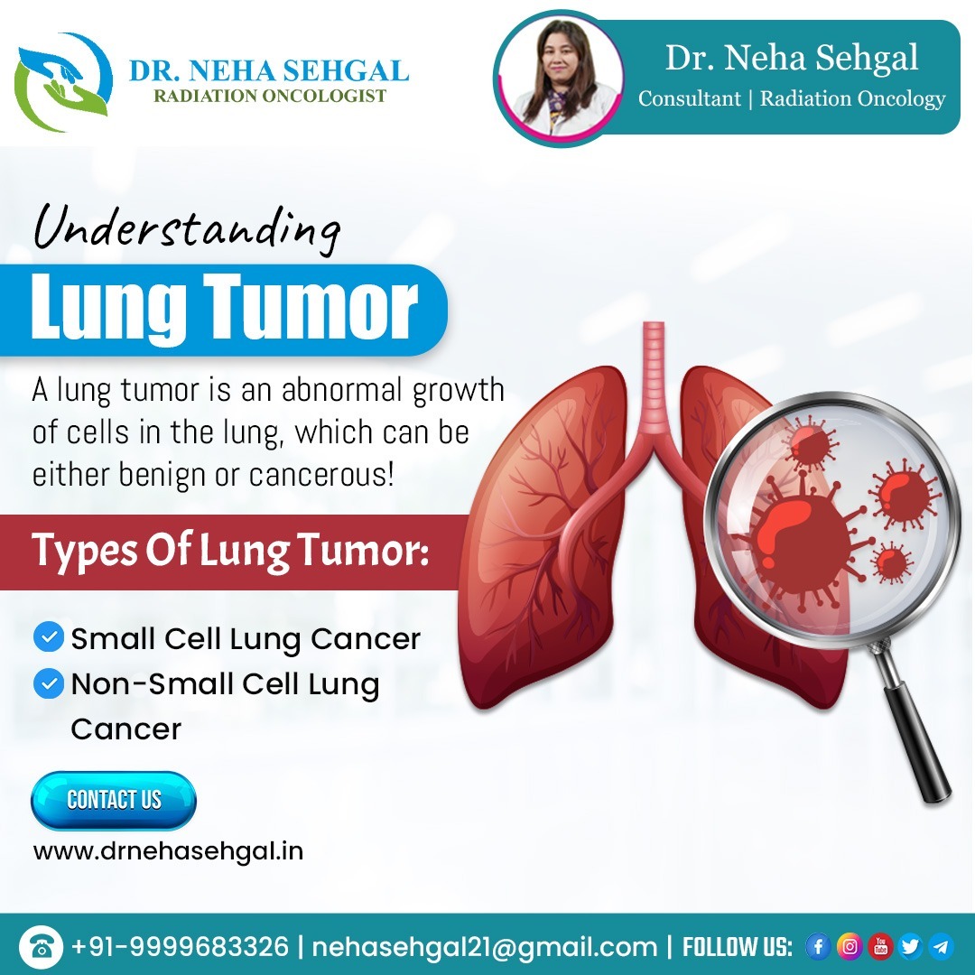 Best Lung Cancer Treatment